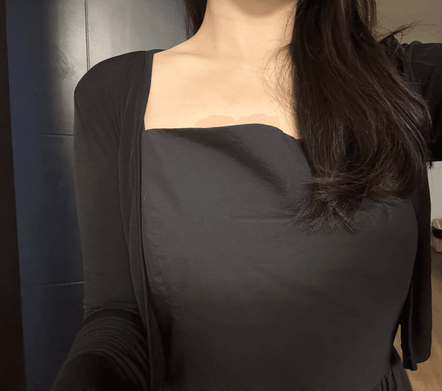 애프터 — 체형교정 후