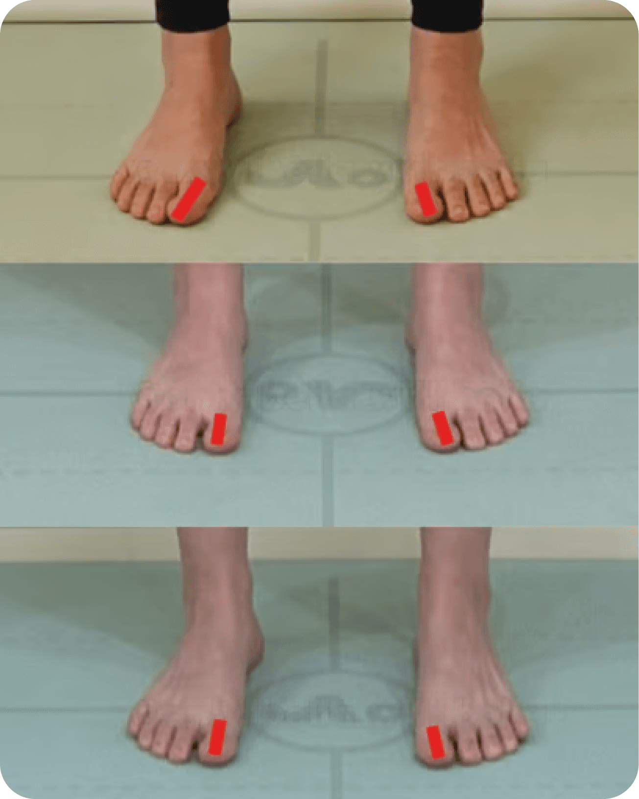 Before & After